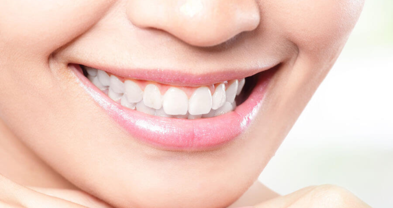 10 tips about how to prolong your teeth whitening results