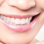 10 tips about how to prolong your teeth whitening results