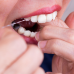 teeth extraction at home safely