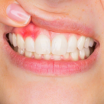 the dangers of neglecting swollen gums and gum disease