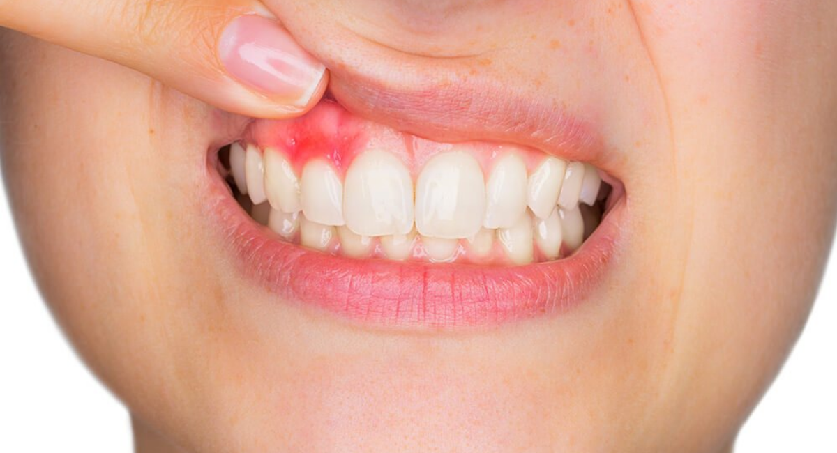 the dangers of neglecting swollen gums and gum disease