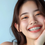 why braces are still one of the best orthodontic treatments