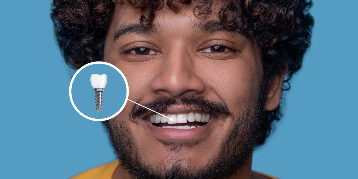 Foods to Eat and Avoid for a Smooth Dental Implant Recovery
