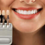 Dental Veneers - Who Is a Good Candidate and What Can They Fix