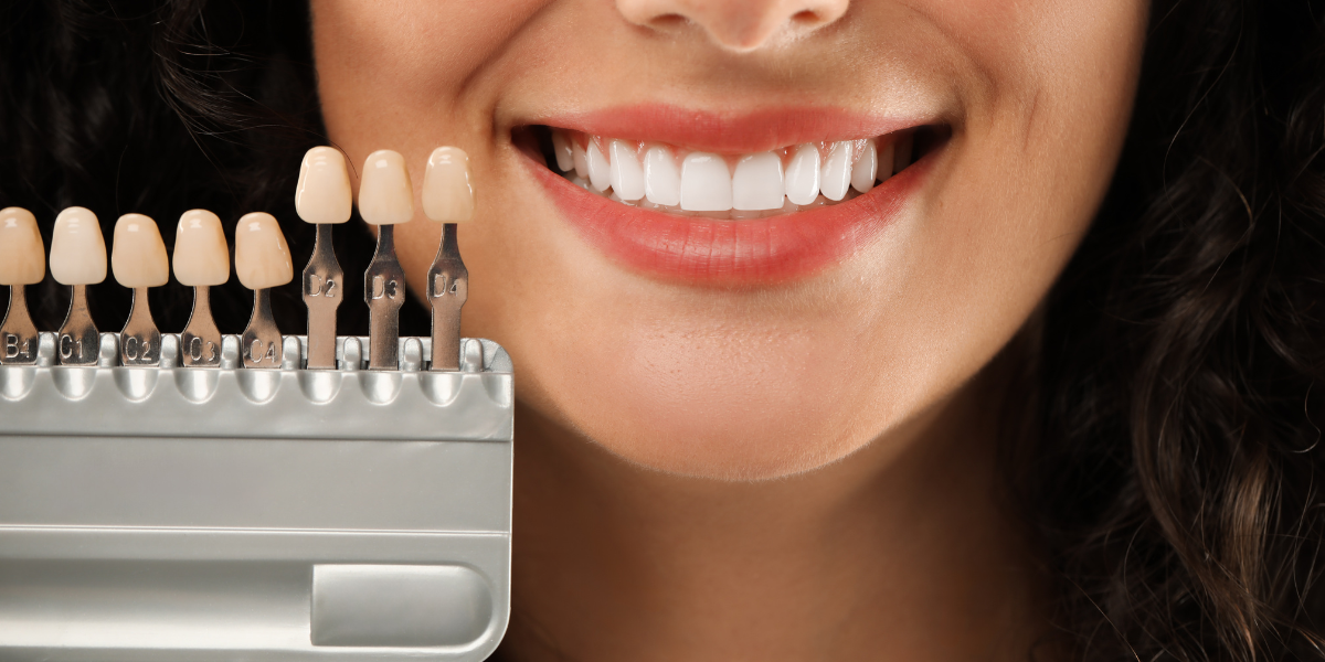 Dental Veneers - Who Is a Good Candidate and What Can They Fix